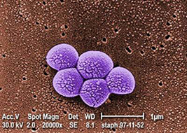 an image of the Methicillin-Resistant Staphylococcus Aureus bacteria in a lab environment